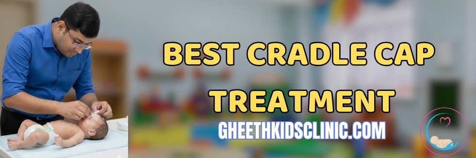 Best Cradle Cap Treatment​